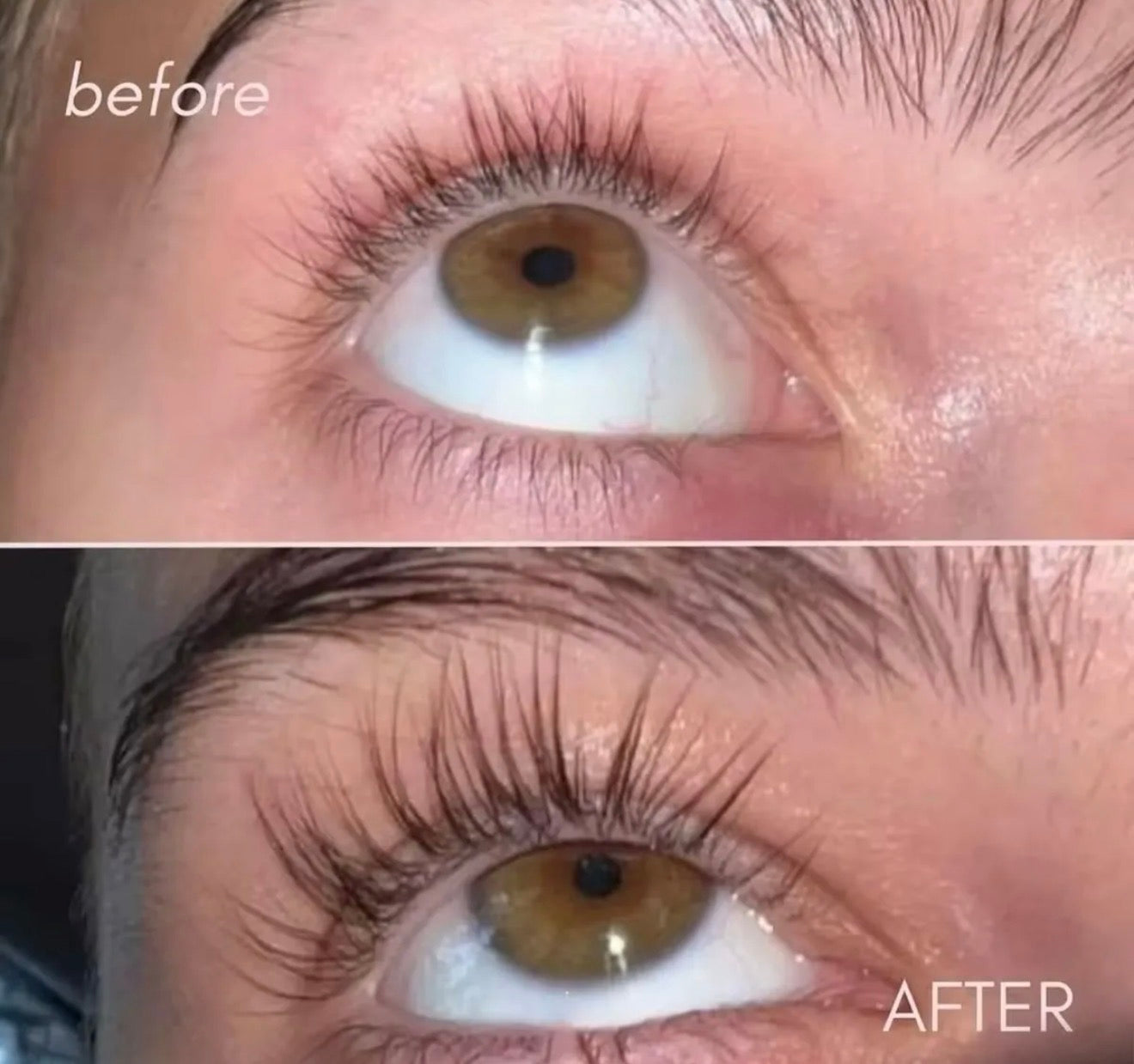 Versox Serum