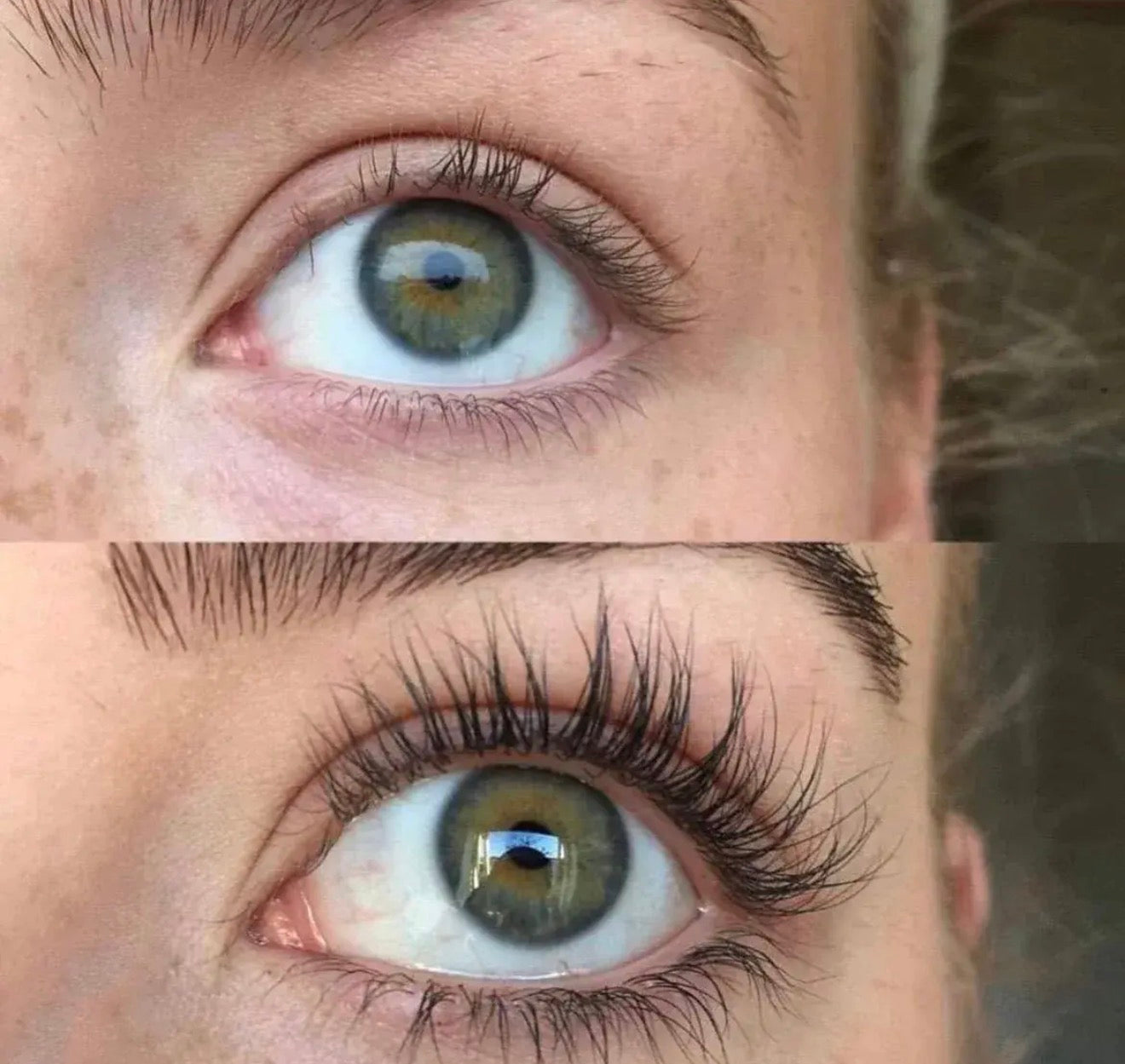 Versox Serum