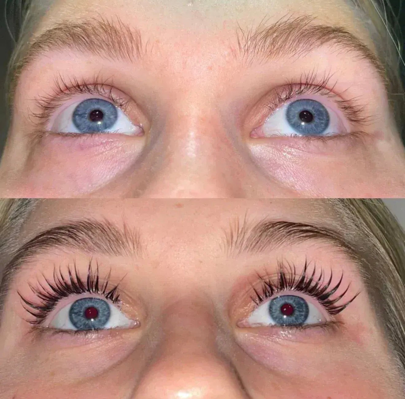 Versox Serum